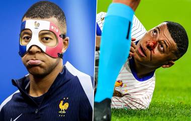 Kylian Mbappe Injury Mask: ভাঙা নাকে ডাচদের বিপক্ষে মুখোশ পরে নামবেন এমবাপে! কিন্তু মিলবে কি অনুমতি