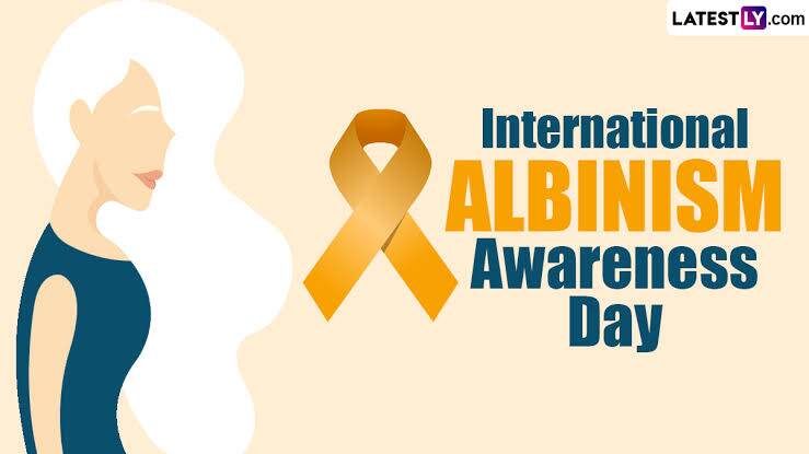 International Albinism Awareness Day 2024: অ্যালবিনিজম কী? আন্তর্জাতিক অ্যালবিনিজম সচেতনতা দিবস উপলক্ষে জেনে নিন এই রোগের লক্ষণ, কারণ ও প্রতিরোধ সম্বন্ধে বিস্তারিত...