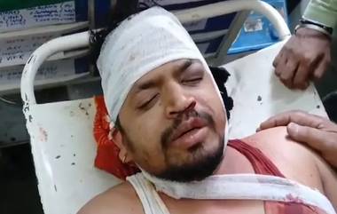 Professor Attacked By Students: কলেজ ক্যাম্পাসে অধ্যাপককে লাঠি দিয়ে মারধর একদল ছাত্রের, চোখে ছিটিয়ে দেওয়া হল লঙ্কার গুঁড়ো!